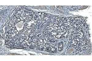 IHC analysis of TIMM8A/DDP using anti-TIMM8A/DDP antibody (ABIN7600039). (TIMM8A/DDP 抗体  (AA 14-97))
