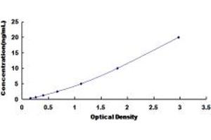 Typical standard curve (EPHA1 ELISA 试剂盒)