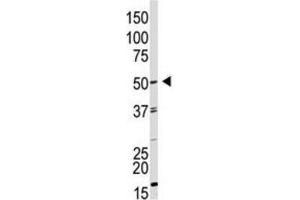 Western Blotting (WB) image for anti-Growth Differentiation Factor 9 (GDF9) antibody (ABIN3001444) (GDF9 抗体)