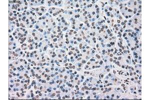 Image no. 3 for anti-Checkpoint Kinase 2 (CHEK2) antibody (ABIN1497498) (CHEK2 抗体)