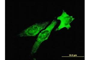 Immunofluorescence (IF) image for anti-Tumor Susceptibility Gene 101 (TSG101) antibody (ABIN781822) (TSG101 抗体)