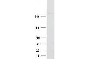 Validation with Western Blot
