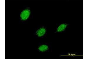 Immunofluorescence of monoclonal antibody to LHX5 on HeLa cell. (LHX5 抗体  (AA 136-235))