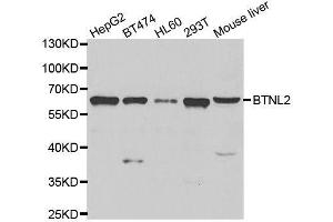 Western blot analysis of extracts of various cell lines, using BTNL2 antibody. (BTNL2 抗体  (AA 246-455))