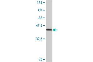 Western Blot detection against Immunogen (38. (ACAT2 抗体  (AA 104-213))