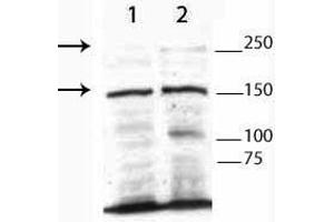 Western Blot of Rabbit Anti-TET3 Antibody. (TET3 抗体  (N-Term))