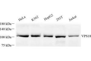 Western blot analysis of VPS18 (ABIN7076177) at dilution of 1: 500 (VPS18 抗体)