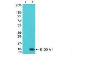 Western blot analysis of extracts from 293 cells (Lane 2), using S100 A1 antiobdy. (S1A1 抗体)