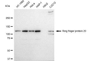 anti-Ring Finger Protein 20 (RNF20) antibody