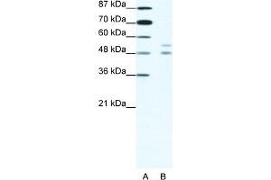WB Suggested Anti-MITF Antibody Titration:  1. (MITF 抗体  (N-Term))
