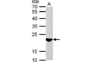 WB Image SOCS1 antibody detects SOCS1 protein by Western blot analysis. (SOCS1 抗体  (C-Term))