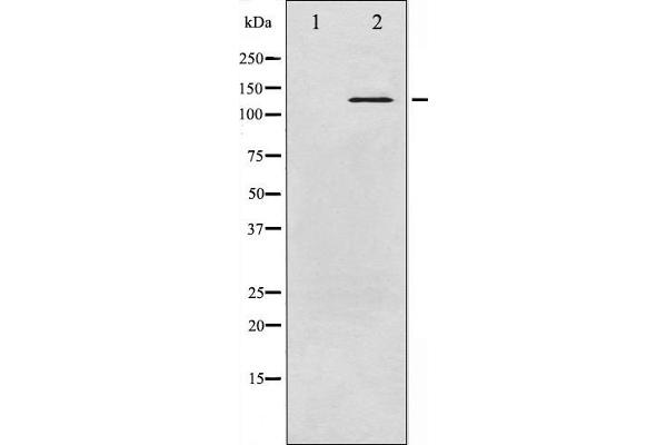 ABL1 抗体  (pTyr245)