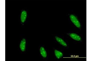 Immunofluorescence (IF) image for anti-TAF6-Like RNA Polymerase II, P300/CBP-Associated Factor (PCAF)-Associated Factor, 65kDa (TAF6L) (AA 2-109) antibody (ABIN564636)