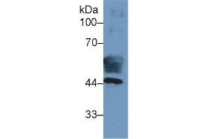 Detection of CK19 in Human Placenta lysate using Monoclonal Antibody to Cytokeratin 19 (CK19) (Cytokeratin 19 抗体  (AA 127-322))