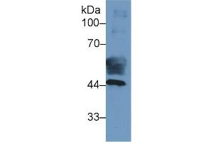 Detection of CK19 in Human Placenta lysate using Monoclonal Antibody to Cytokeratin 19 (CK19)