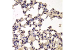 Immunohistochemistry of paraffin-embedded Mouse lung using HDAC7 antibody at dilution of 1:100 (x400 lens). (HDAC7 抗体)