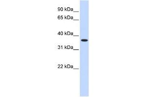 Western Blotting (WB) image for anti-Zinc Finger Protein 444 (ZNF444) antibody (ABIN2458190) (ZNF444 抗体)