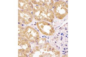 Antibody staining APIP in human kidney tissue sections by Immunohistochemistry (IHC-P - paraformaldehyde-fixed, paraffin-embedded sections). (APIP 抗体  (AA 111-142))