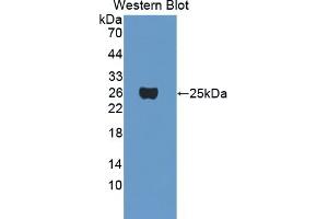 Detection of Recombinant CRYgF, Mouse using Polyclonal Antibody to Crystallin Gamma F (CRYgF) (CRYGF 抗体  (AA 1-173))