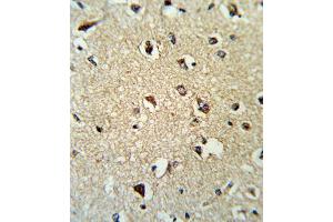 Immunohistochemistry (IHC) image for anti-rho GDP Dissociation Inhibitor (GDI) alpha (ARHGDIA) antibody (ABIN3001701) (ARHGDIA 抗体)