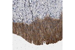 Immunohistochemical staining of human urinary bladder with PPAPDC2 polyclonal antibody  shows strong cytoplasmic positivity in urothelial cells at 1:50-1:200 dilution. (PPAPDC2 抗体)