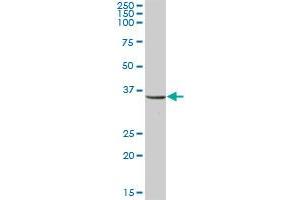 UMPS MaxPab polyclonal antibody. (UMPS 抗体  (AA 1-480))