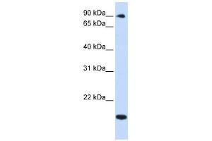 TSR1 antibody used at 1 ug/ml to detect target protein. (TSR1 抗体)