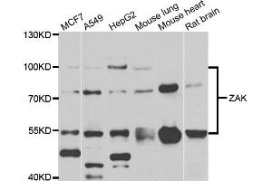 Western blot analysis of extracts of various cell lines, using ZAK antibody. (ZAK 抗体)
