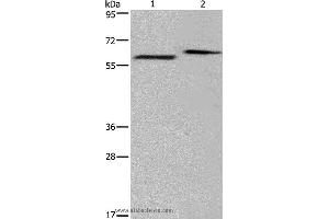 Western blot analysis of Human fetal brain and mouse brain tissue, using EGR4 Polyclonal Antibody at dilution of 1:400 (EGR4 抗体)