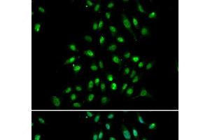 Immunofluorescence analysis of A549 cells using CXXC1 Polyclonal Antibody (CXXC1 抗体)