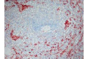 Image no. 1 for anti-Ionized Calcium-binding Adapter Molecule 1 (IBA1) antibody (ABIN379966) (Iba1 抗体)