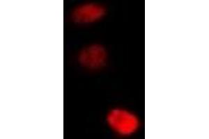 Immunofluorescent analysis of STAMBP staining in U2OS cells. (STAMBP 抗体)