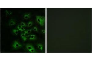 Immunofluorescence analysis of HeLa cells treated with EGF 200nM 5', using HER4 (Phospho-Tyr1284) Antibody. (ERBB4 抗体  (pTyr1284))