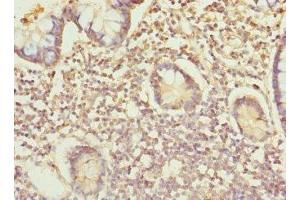 Immunohistochemistry of paraffin-embedded human small intestine tissue using ABIN7156305 at dilution of 1:100 (IP6K2 抗体  (AA 1-180))