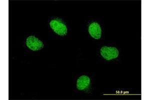 Immunofluorescence of monoclonal antibody to FOXQ1 on HeLa cell. (FOXQ1 抗体  (AA 110-219))