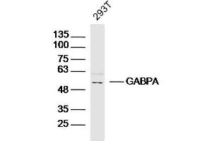 293T lysates probed with GABPA Polyclonal Antibody, Unconjugated  at 1:300 dilution and 4˚C overnight incubation. (GABPA 抗体  (AA 51-150))
