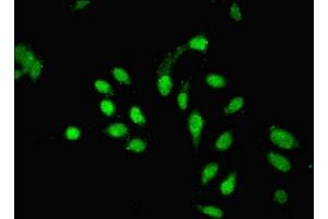 Immunofluorescent analysis of Hela cells using ABIN7163042 at dilution of 1:100 and Alexa Fluor 488-congugated AffiniPure Goat Anti-Rabbit IgG(H+L) (PHF1 抗体  (AA 151-360))