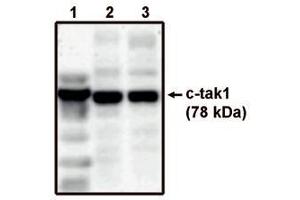 Image no. 1 for anti-MAP/microtubule Affinity-Regulating Kinase 3 (MARK3) antibody (ABIN793597) (MARK3 抗体)