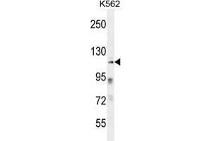 ZNF99 Antibody (N-term) western blot analysis in K562 cell line lysates (35 µg/lane). (ZNF99 抗体  (N-Term))