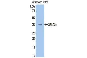 Western blot analysis of the recombinant protein. (Prothrombin 抗体  (AA 325-618))