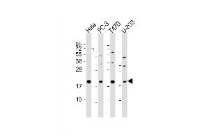 All lanes : Anti-ANC11 Antibody (C-Term) at 1:2000 dilution Lane 1: Hela whole cell lysate Lane 2: PC-3 whole cell lysate Lane 3: T47D whole cell lysate Lane 4: U-2OS whole cell lysate Lysates/proteins at 20 μg per lane. (ANAPC11 抗体  (AA 56-94))