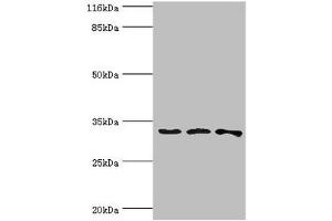 Western blot All lanes: STARD10 antibody at 2 μg/mL Lane 1: 293T whole cell lysate Lane 2: k562 whole cell lysate Lane 3: Mouse heart tissue Secondary Goat polyclonal to rabbit IgG at 1/10000 dilution Predicted band size: 33 kDa Observed band size: 33 kDa (STAR 抗体  (AA 1-291))