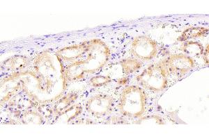 Immunohistochemistry (IHC) image for anti-NADPH Oxidase 1 (NOX1) (Internal Region) antibody (ABIN768583)