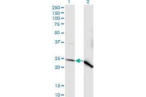 Western Blotting (WB) image for anti-NADH Dehydrogenase (Ubiquinone) Flavoprotein 2, 24kDa (NDUFV2) (AA 150-249) antibody (ABIN518268)