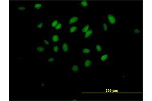 Immunofluorescence of purified MaxPab antibody to MXD3 on HeLa cell. (MXD3 抗体  (AA 1-206))