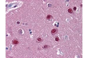 Immunohistochemistry (IHC) image for anti-Nuclear Receptor Subfamily 1, Group D, Member 1 (NR1D1) (AA 1-615) antibody (ABIN614695) (NR1D1 抗体  (AA 1-615))