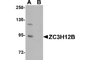 Western Blotting (WB) image for anti-Zinc Finger CCCH-Type Containing 12B (ZC3H12B) (N-Term) antibody (ABIN1031673)