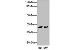 Western blot All lanes: NIT2 antibody at 3 μg/mL Lane 1: Mouse heart tissue Lane 2: A549 whole cell lysate Secondary Goat polyclonal to rabbit IgG at 1/10000 dilution Predicted band size: 31 kDa Observed band size: 31 kDa (NIT2 抗体  (AA 1-276))