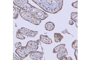 anti-WD Repeat Domain 44 (WDR44) (AA 188-913) antibody