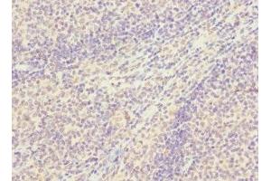 Immunohistochemistry of paraffin-embedded human tonsil tissue using ABIN7170368 at dilution of 1:100 (SNX18 抗体  (AA 449-628))